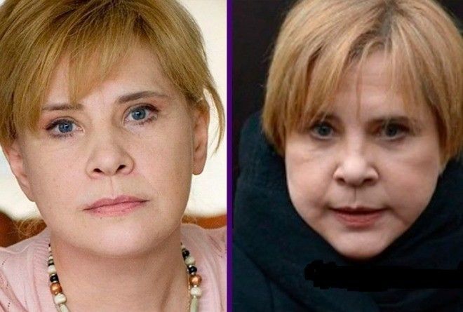 Татьяна догилева до и после пластики