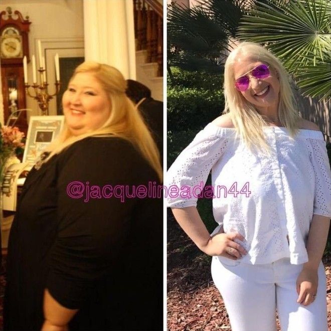 Жаклин Адан, Jacqueline Adan, ноги после похудения, похудела на 160 кг, тело после сильного похудения