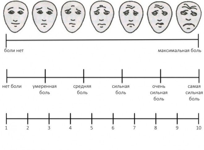 Картинки по запросу визуально аналоговая шкала боли