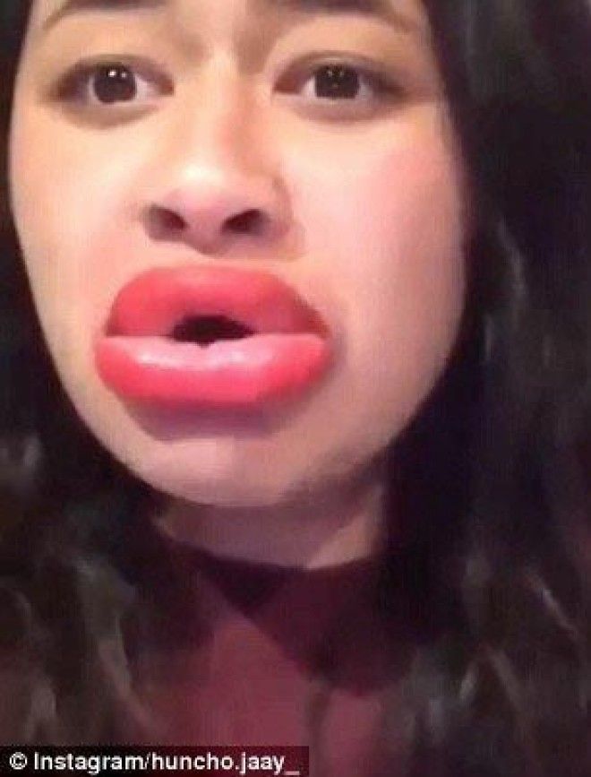 губы как у Кайли Дженнерkyliejennerchallenge экстремальное увеличение губ засовывают губы в маленькие баночки увеличение губ отек