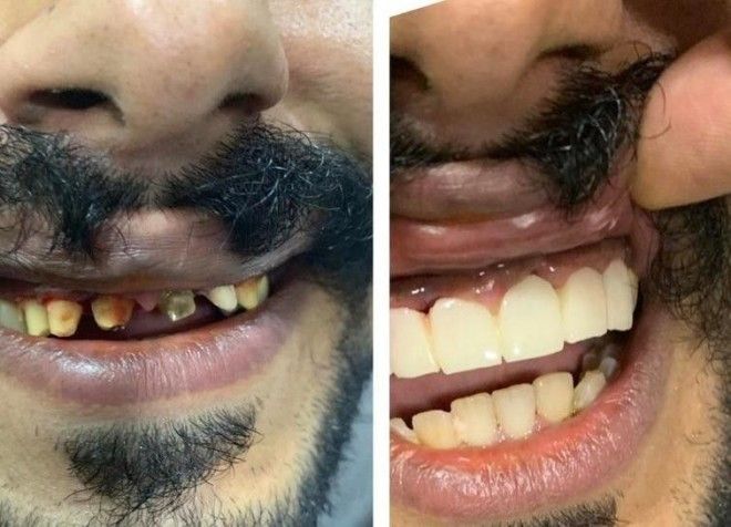 Lюди выставляют фото до и после и тут всё от похудения до исправления зубов