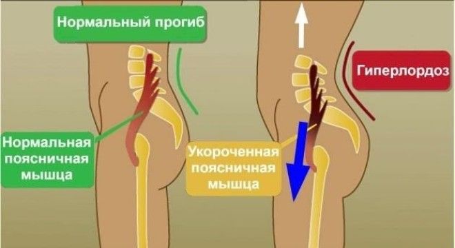 Как сесть на продольный шпагат и зачем это нужно