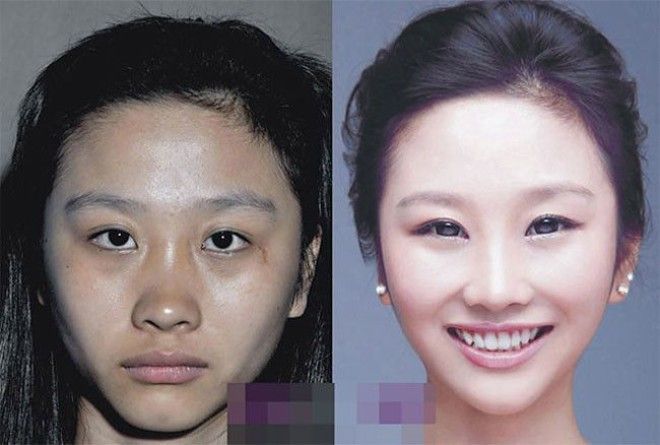 SЧудеса пластики 20 невероятных преображений южнокорейских женщин