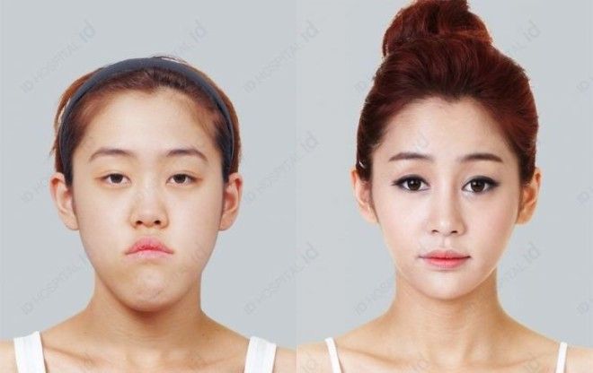 SЧудеса пластики 20 невероятных преображений южнокорейских женщин