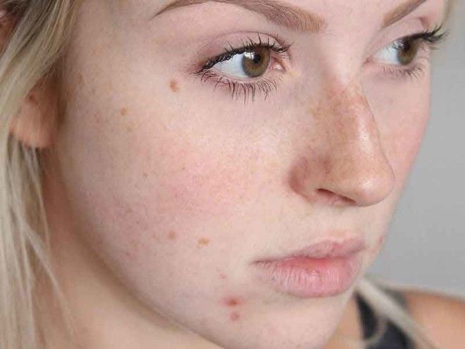 как очистить кишечник