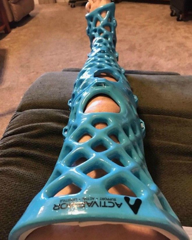 3D гипс Фото Reddit