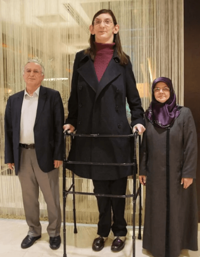 SСамой высокой девушке живется не сладко и это факт