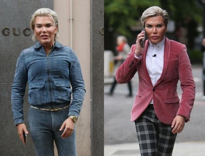 SЗвезды которые уменьшили себе желудок чтобы похудеть