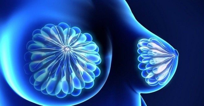 польза и вред лифчика