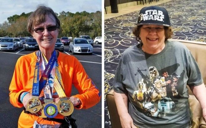 26 неизбежных изменений в организме, которые мы можем наблюдать каждые 10 лет