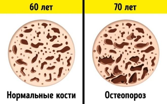 26 неизбежных изменений в организме, которые мы можем наблюдать каждые 10 лет