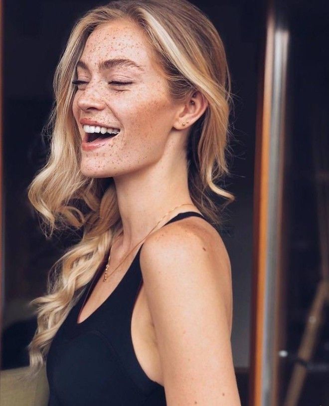 Немецкая модель хвастается огромным количеством веснушек