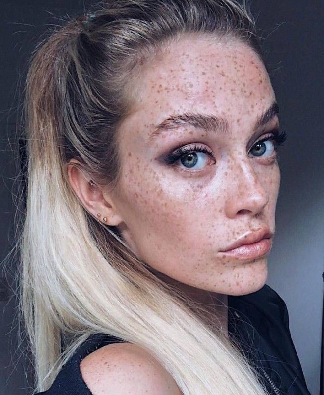 Немецкая модель хвастается огромным количеством веснушек