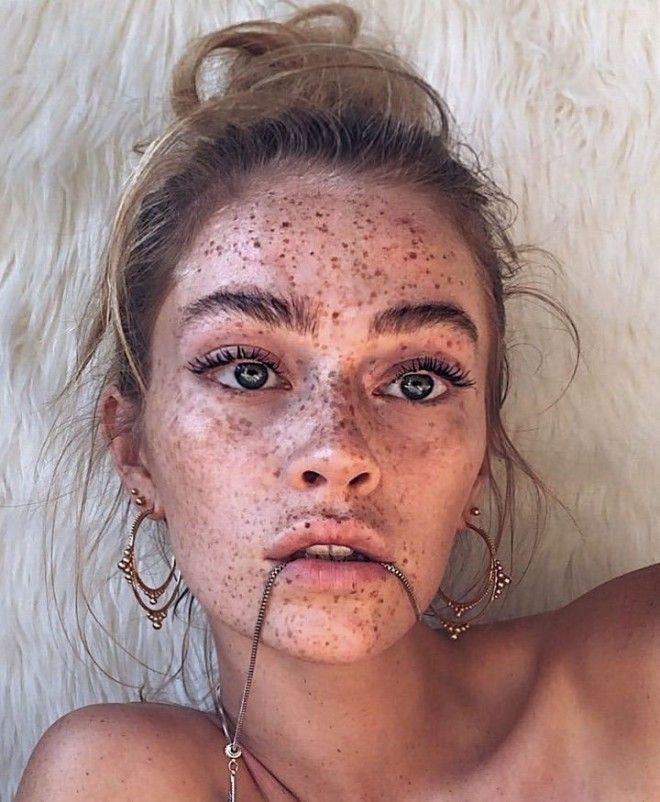 Немецкая модель хвастается огромным количеством веснушек