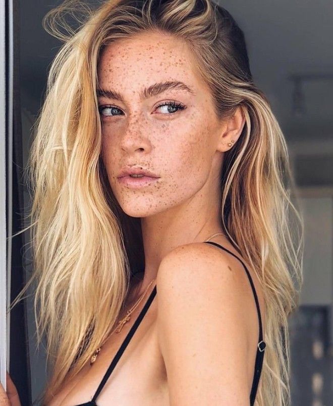 Немецкая модель хвастается огромным количеством веснушек