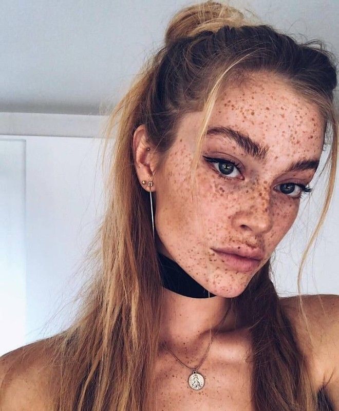 Немецкая модель хвастается огромным количеством веснушек