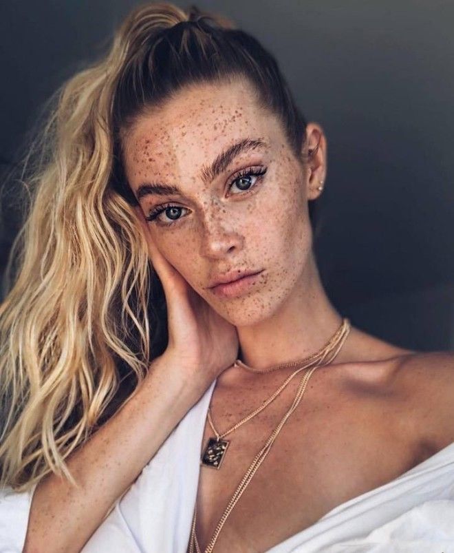 Немецкая модель хвастается огромным количеством веснушек