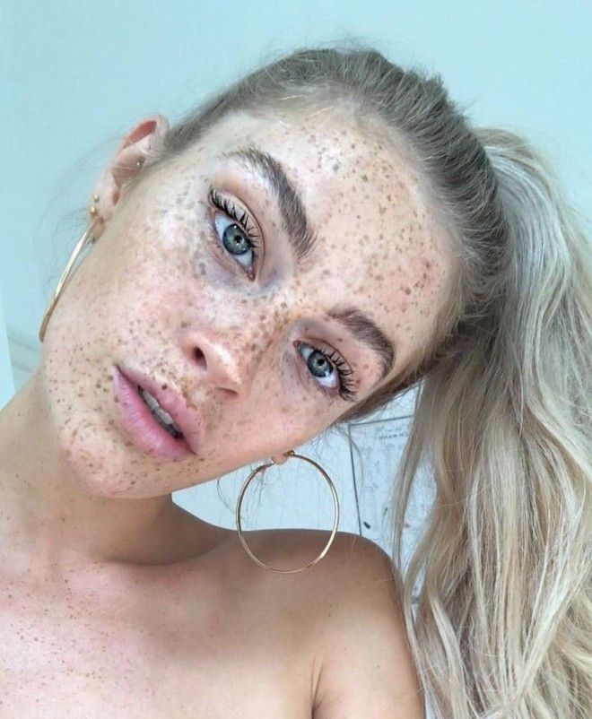 Немецкая модель хвастается огромным количеством веснушек