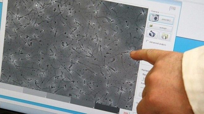 Кровь, сперма, волосы и яйцеклетка: сколько можно заработать, если продать себя по частям-5 фото-