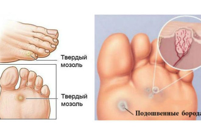 Действительно работает!