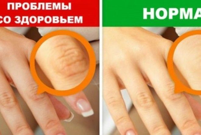 Забота о здоровье никогда не бывает лишней!