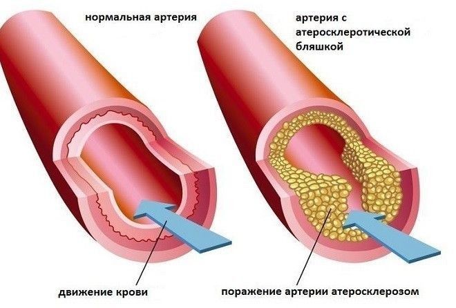  Врачи молчат об этом!