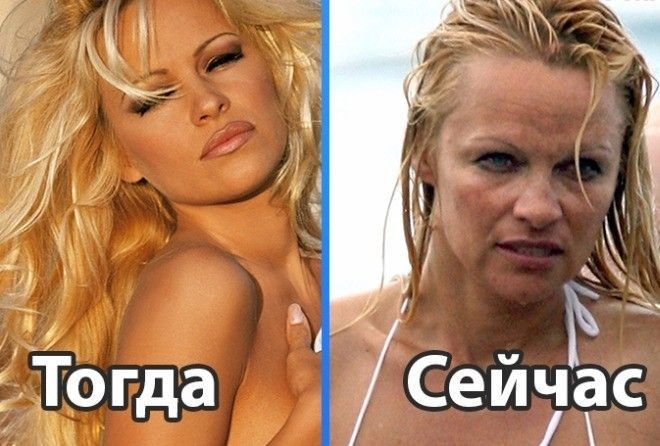 А время бежит...