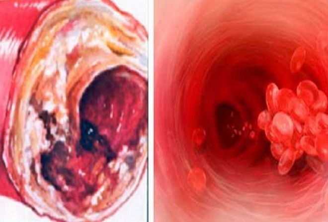 1000-летний немецкий рецепт.