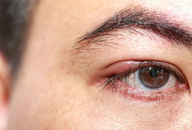 Медлить в таких случаях не стоит